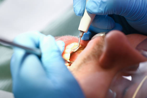 Best Emergency Gum Treatment in Lake Don Pedro, CA