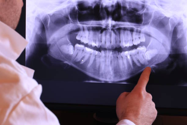 Best Cosmetic Emergency Dentistry in Lake Don Pedro, CA